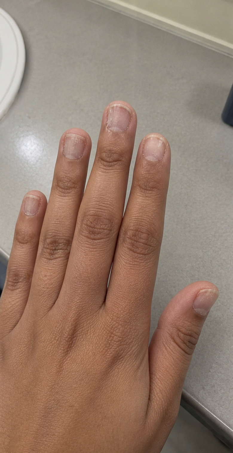 Before